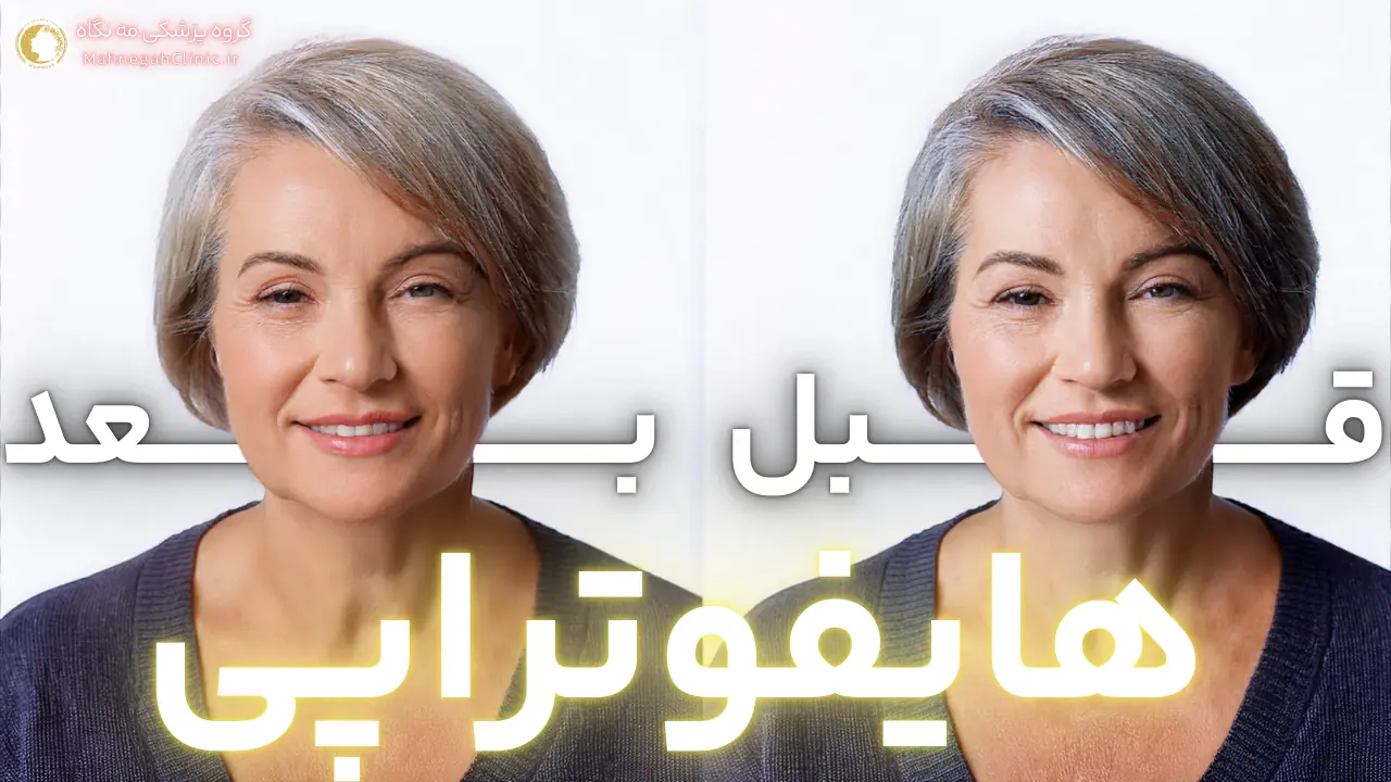 مرکز هایفوتراپی سعادت آباد