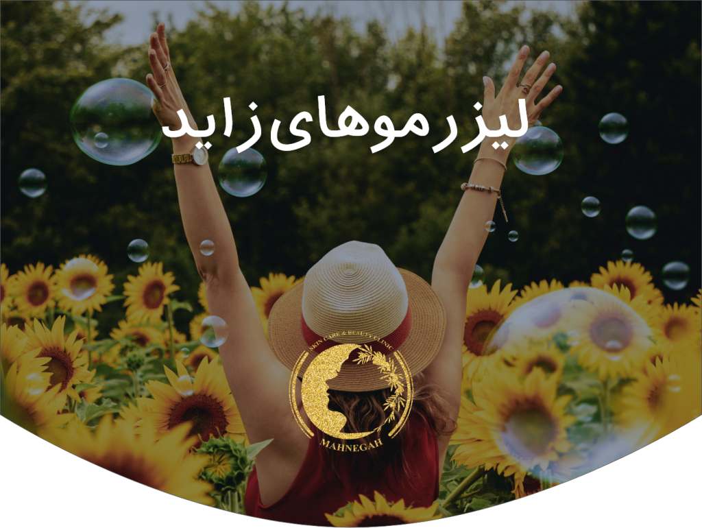 لیزر موهای زائد