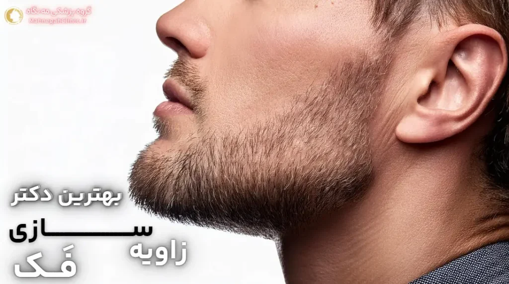 انتخاب دکتر خوب برای جراحی فک و صورت