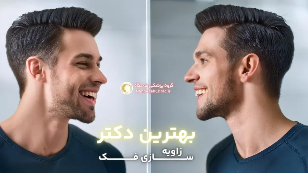 بهترین دکتر زاویه فک برای صورت آقایان