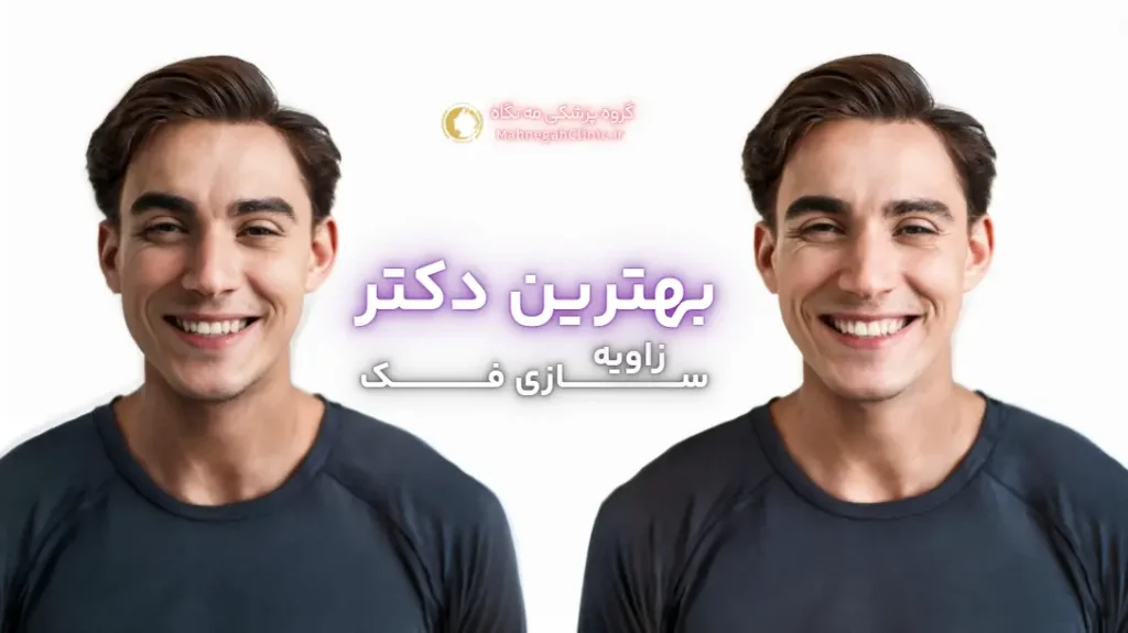 بهترین دکتر زاویه فک برای صورت آقایان در تهران