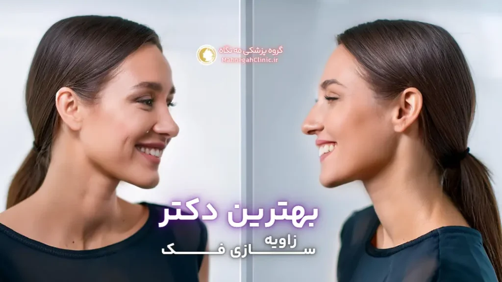 بهترین دکتر زاویه فک برای صورت خانم ها