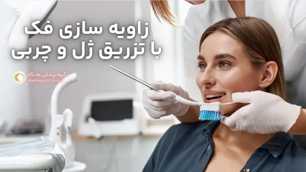تجربه داشتن زاویه فک با تزریق ژل یا چربی
