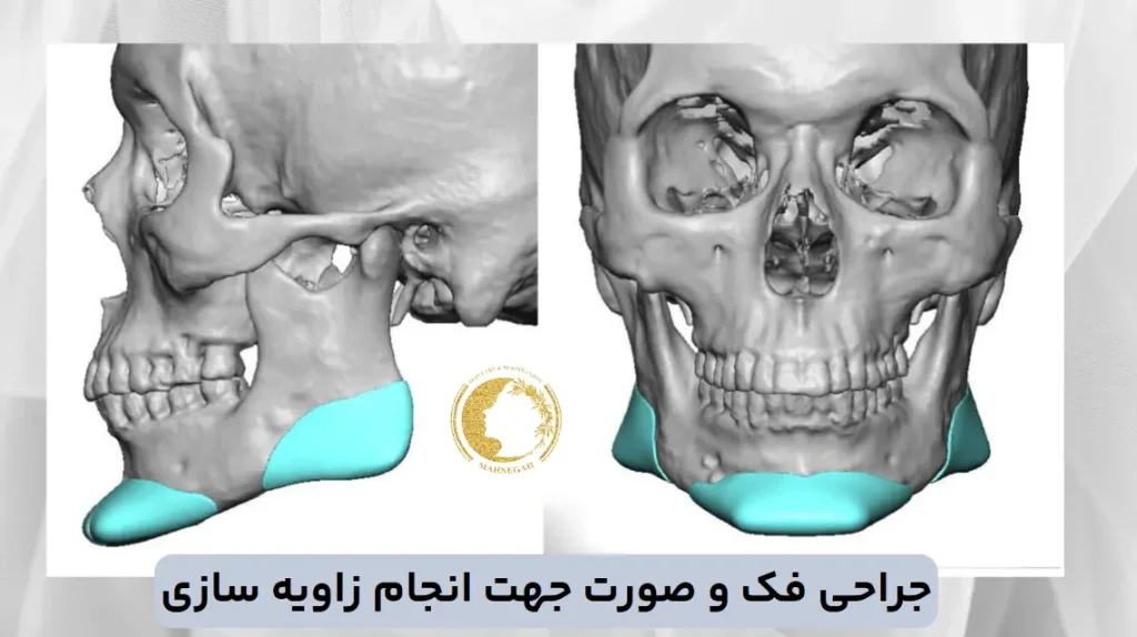 تصویر اسکلت سر انسان جهت انجام زاویه سازی