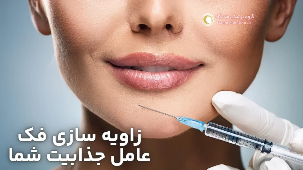زاویه سازی فک با ژل و فیلر عامل جذابیت شماست