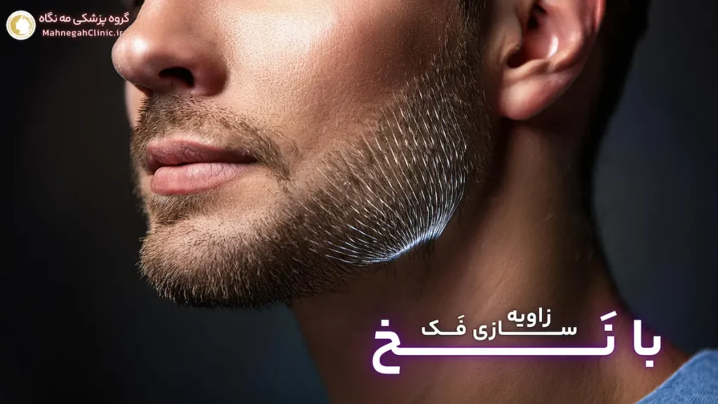 آقایی که زاویه سازی فک با نخ انجام داده