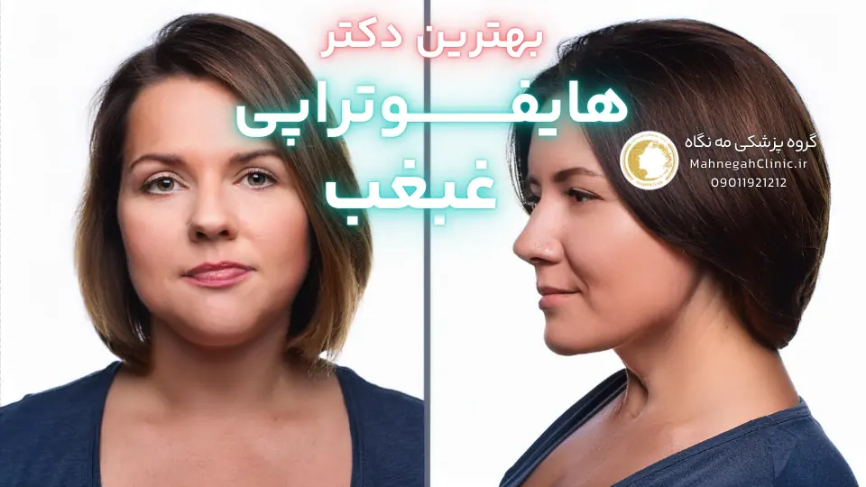 بهترین دکتر هایفوتراپی غبغب در سعادت آباد