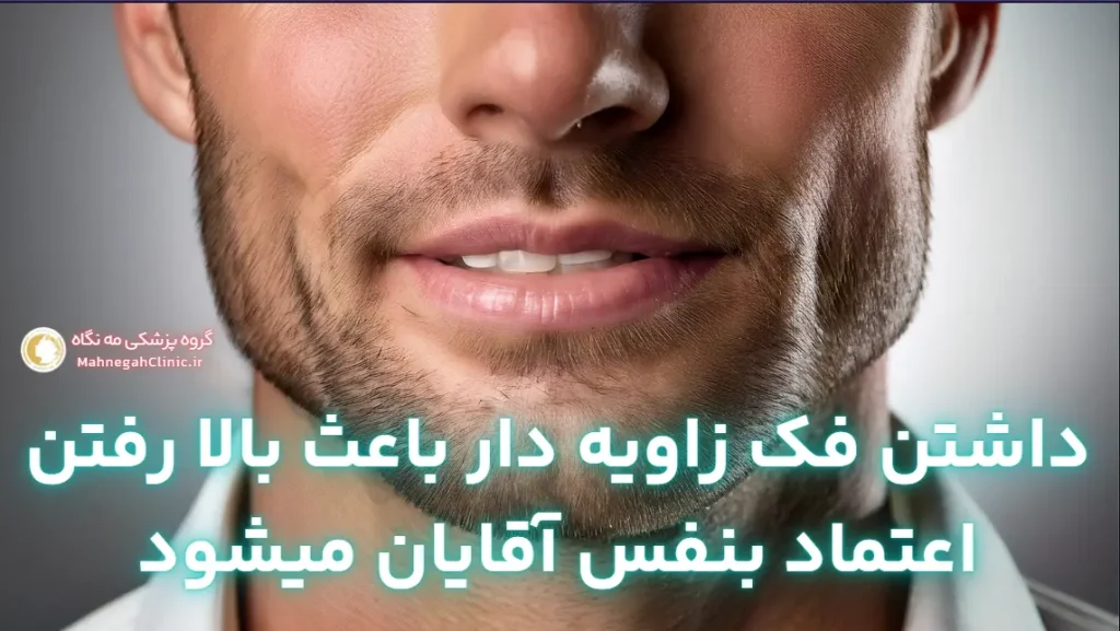 جراحی زیبایی زاویه سازی فک برای آقایان