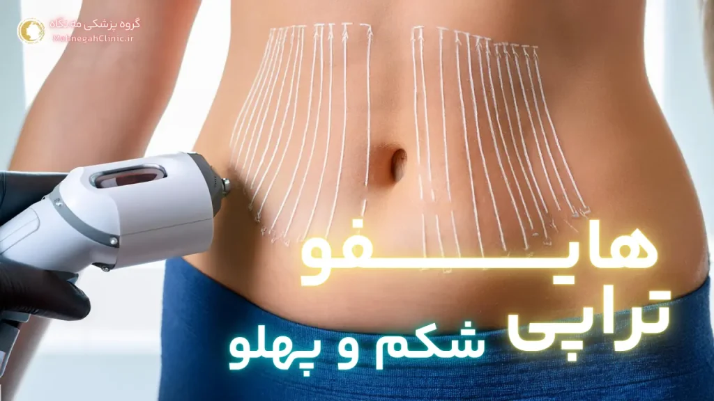 عوارض هایفوتراپی شکم نکات مهم