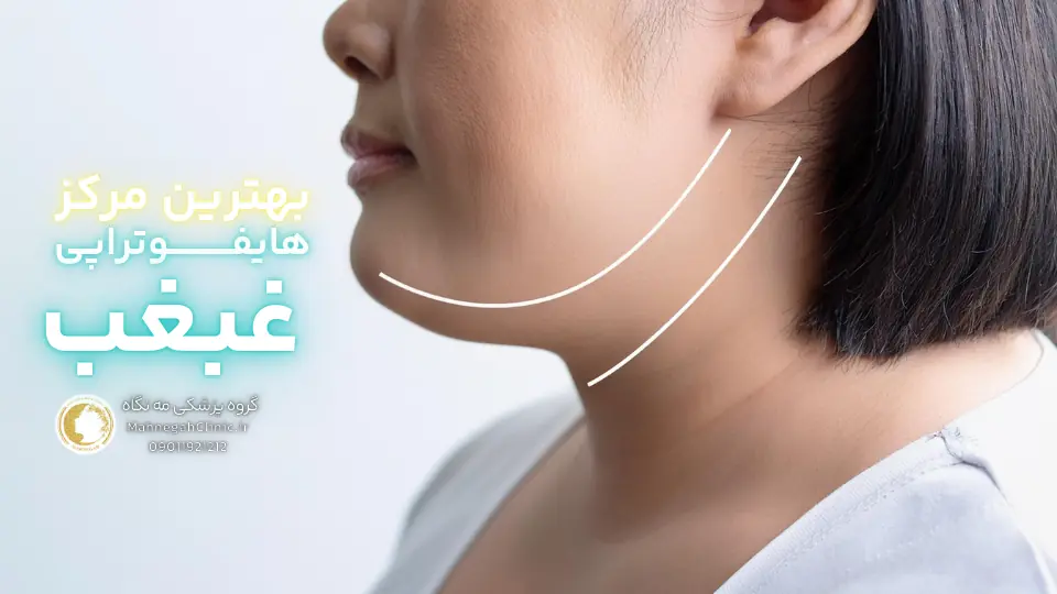 عوارض هایفوتراپی غبغب چیست و چگونه می_توان آنها را کاهش داد