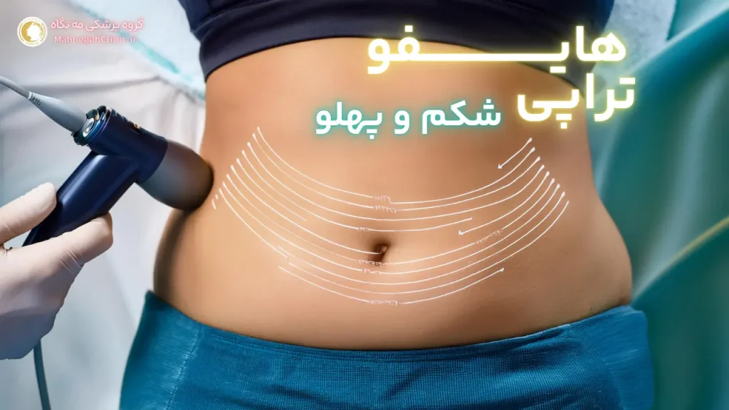عکس قبل و بعد هایفوتراپی شکم گواه اثربخشی