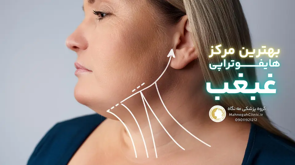قیمت بهترین مرکز هایفوتراپی غبغب در سعادت آباد چقدر است