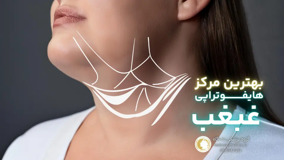ماندگاری هایفوتراپی غبغب چقدر است و چه عواملی بر آن تأثیر می_گذارند