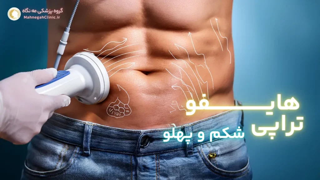 هایفوتراپی برای شکم و پهلو تناسب اندام کامل