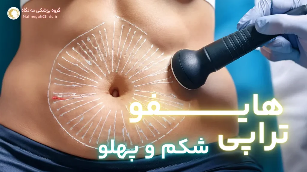 هایفوتراپی شکم و پهلو: هزینهها و مزایا