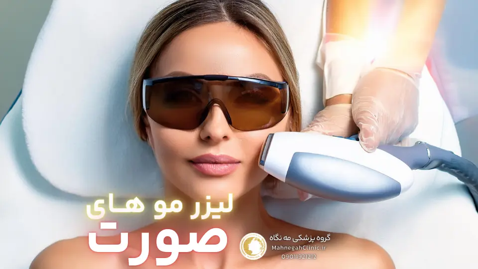 02 مراحل لیزر موهای زائد صورت در سعادت آباد