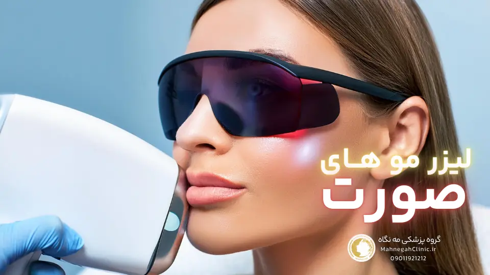 04 لیزر موهای زائد صورت برای آقایان در سعادت آباد